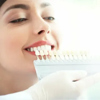 Veneers covered by insurance